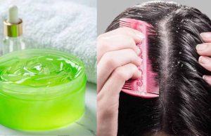 आंवला और एलोवेरा से पाएं डैंड्रफ और हेयर फॉल से छुटकारा – जानें 4 आसान तरीके
