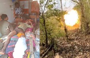 प्रेशर IED विस्फोट की चपेट में आया ग्रामीण बालक, हालत नाजुक
