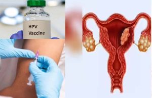 भारत में फेमस हैं HPV वैक्सीन से जुड़े 3 मिथक, डॉक्टर से जानें सही उम्र और सच्चाई