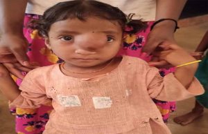 पिता के साये और आर्थिक तंगी के बीच चिरायु योजना बनी सहारा,अंजलि को मिला नया जीवन