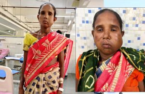 रायपुर: संजीवनी बना मेगा सुपर स्पेशलिटी हेल्थ कैंप, बुधरी मड़कम को मिला नया जीवन