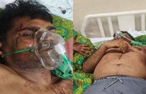 कुल्हाड़ी से हमला: गाली-गलौज का विरोध करने पर पूर्व जनपद सदस्य प्रतिनिधि पर जानलेवा वार